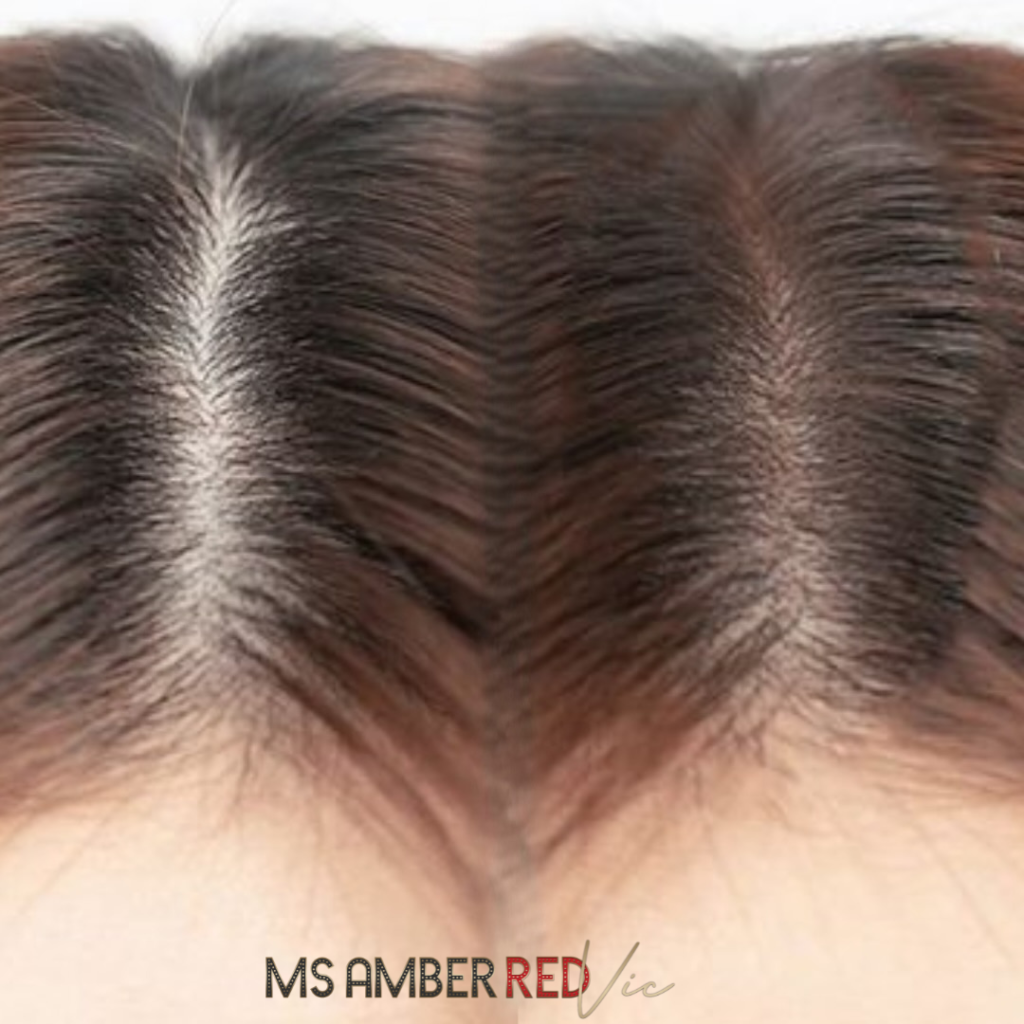 hairloss thinning hair solution for men and women smp scalp micropigmentation msamberred las vegas nevada