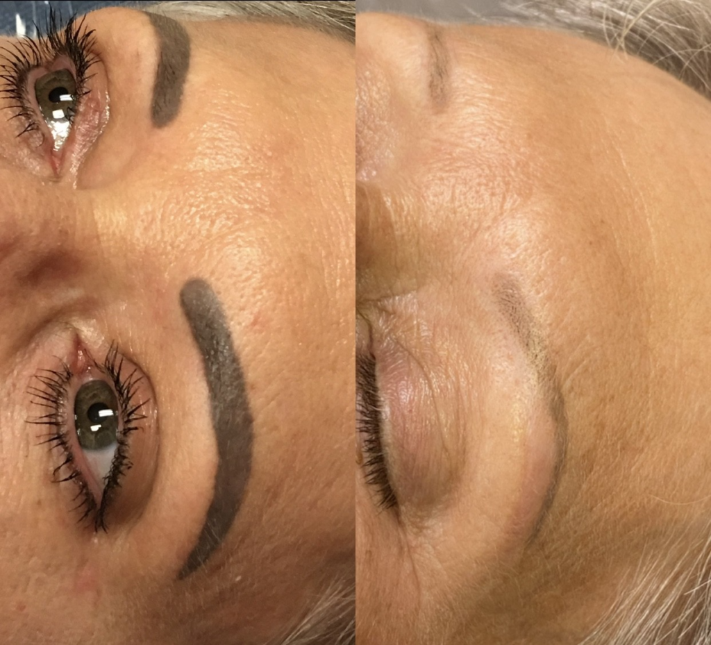 Gray microblading and permanent eyebrow correction before treatment in Las Vegas